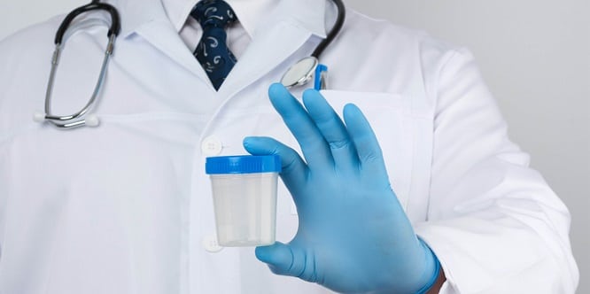 medical professional holding empty urine sample cup
