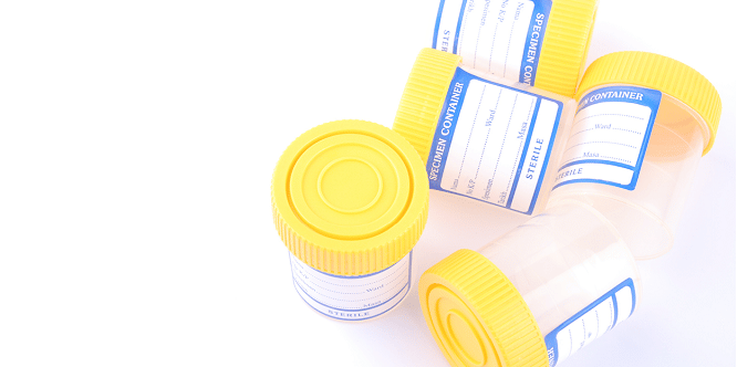 Drug testing urine sample cups