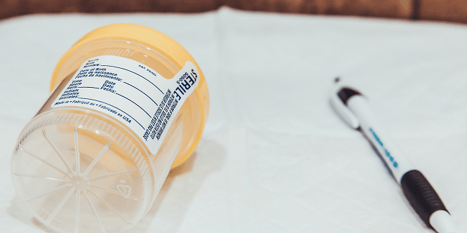 SureHire's Urine Specimen Collection and Dilution Protocols: FAQs